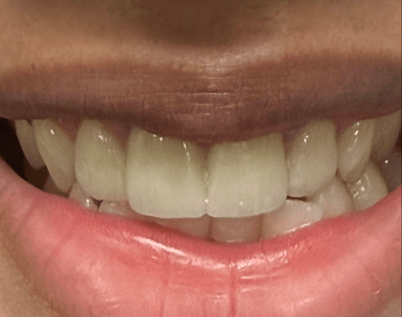Ashmi Singh — Crowns results