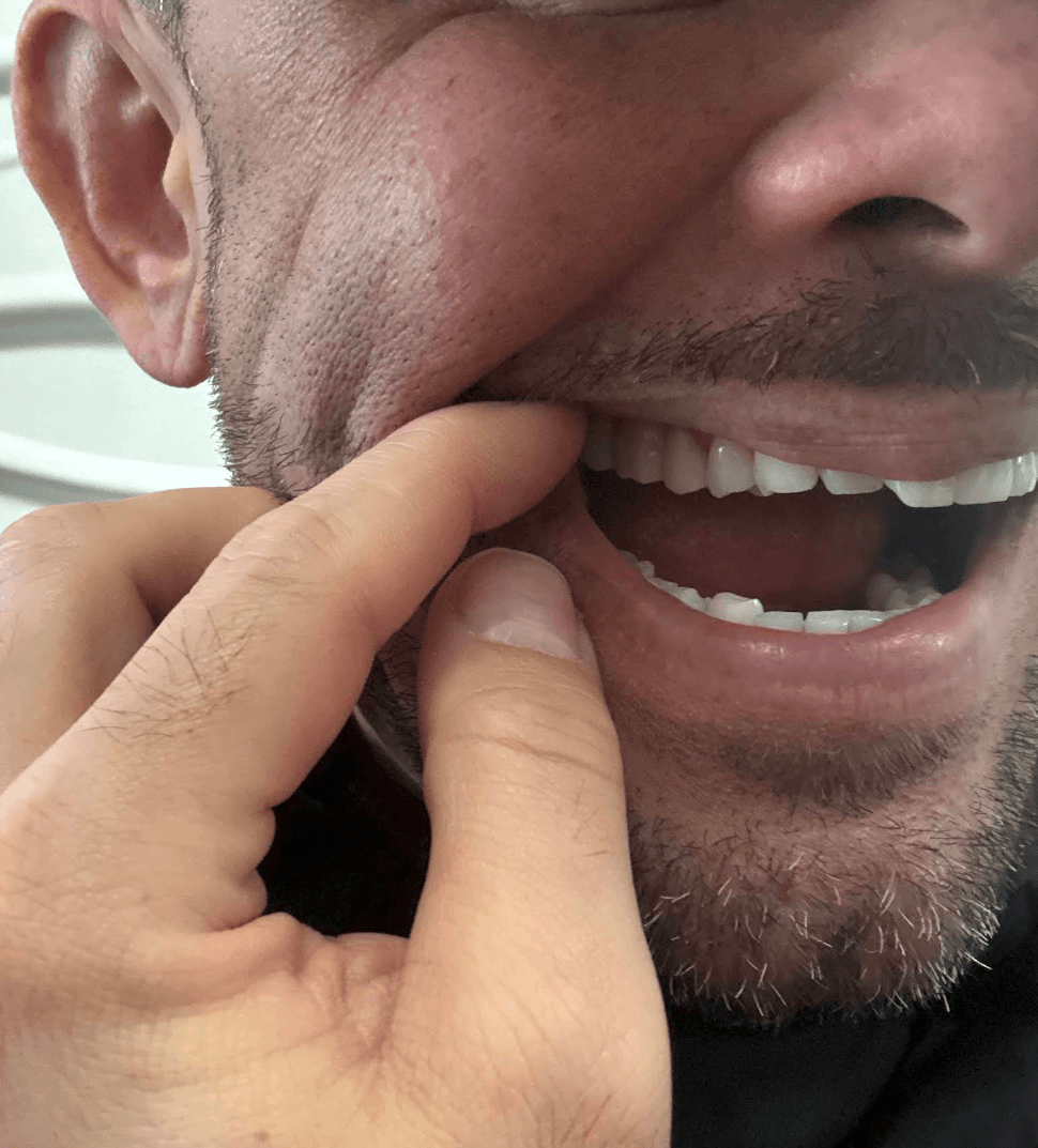 Joe Pascual — Dental Bridge results