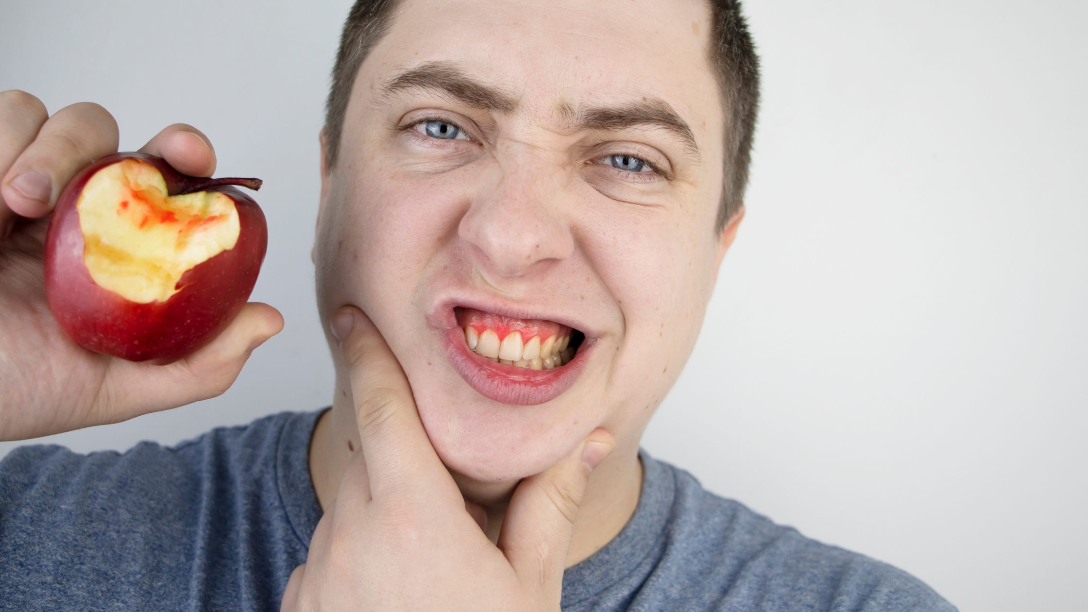 Укус яблока. Укушенное яблоко без передних зубов.